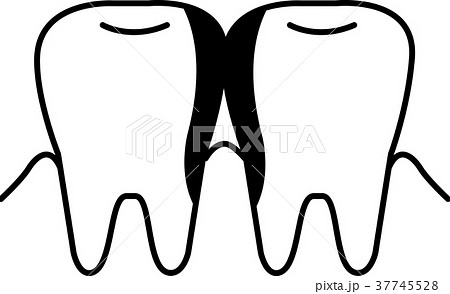 歯と歯の間の虫歯 イラスト モノクロのイラスト素材