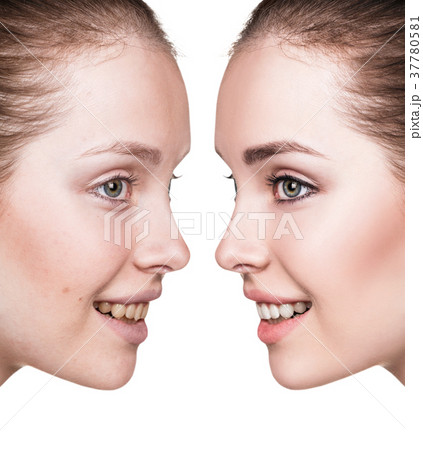 Young woman before and after makeup. Young woman before and after makeup. 37780581