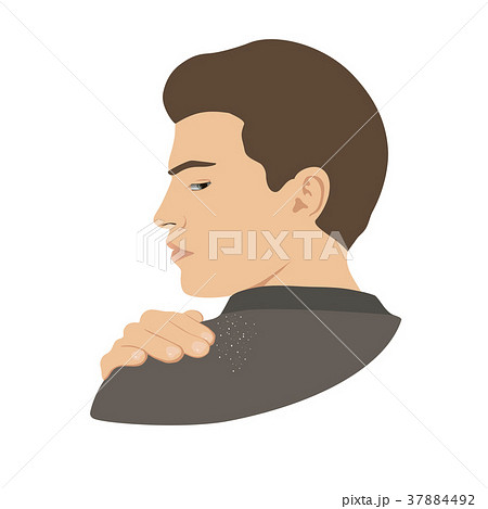 Dandruff on man shoulder. Head, hand, wrist 37884492