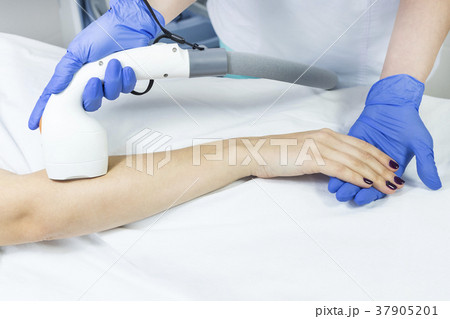 The process of laser depilation of female limbs in The process of laser depilation of female limbs in 37905201