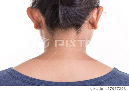 Close up skin of woman neck showing different color from sun UV burning isolated on white 37977298