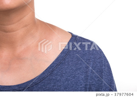 Close up skin of woman neck showing different color from sun UV burning isolated on white 37977604