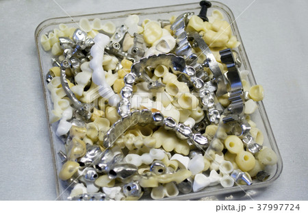 dental bridges close-up 37997724