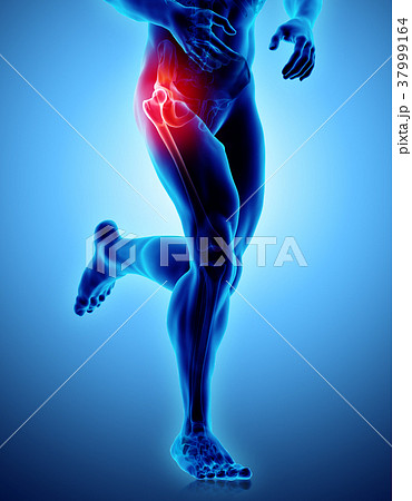 Hip painful skeleton x-ray, 3D illustration. Hip painful skeleton x-ray, 3D illustration. 37999164