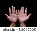 荒れた手 38042205