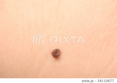mole mole 38110677
