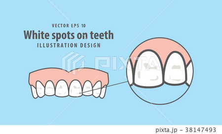White spots on teeth illustration vector 38147493