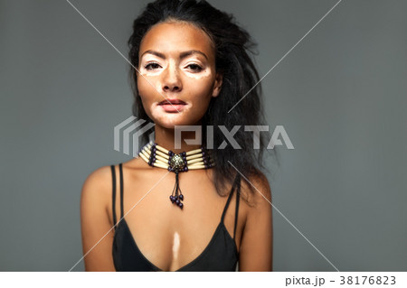 Beautiful African girl studio with skin problems 38176823
