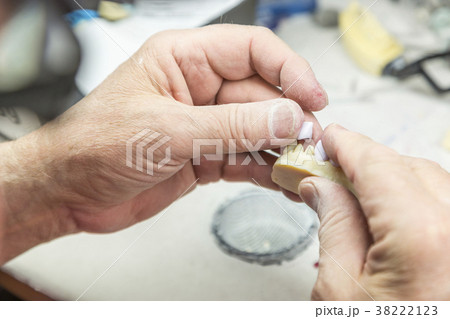Dental Technician Works On 3D Mold Tooth Implants Dental Technician Works On 3D Mold Tooth Implants 38222123