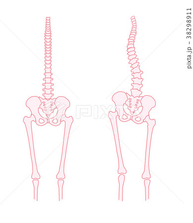 身体の歪み 骨格比較のイラスト素材 3911