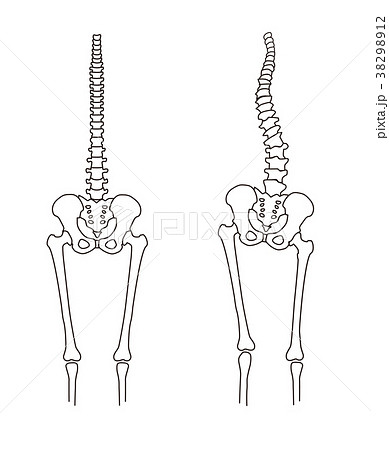 身体の歪み 骨格比較のイラスト素材 38298912 Pixta