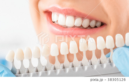 Beautiful smile and white teeth of a young woman. Beautiful smile and white teeth of a young woman. 38305126