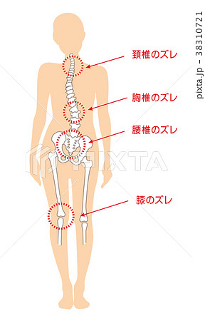 身体の歪み 女性のイラスト素材