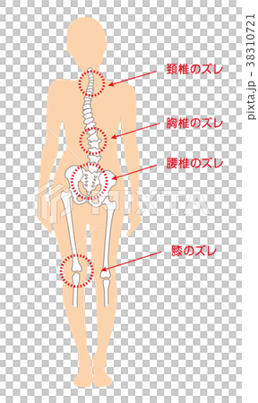 身体の歪み 女性のイラスト素材