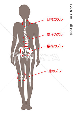 身体の歪み 女性のイラスト素材