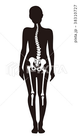 身体の歪み_女性 身体の歪み_女性 38310727