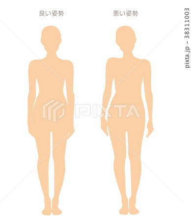 身体の歪み比較 女性 38311003