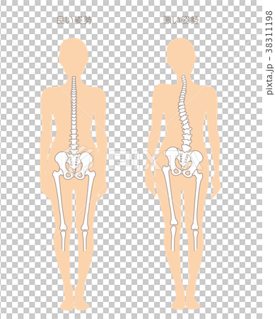 身体の歪み比較 女性 38311198