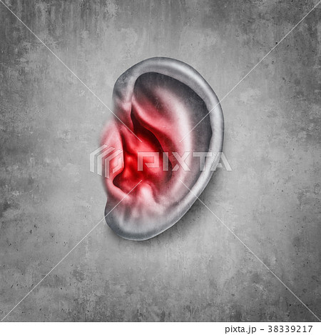 Tinnitus 38339217