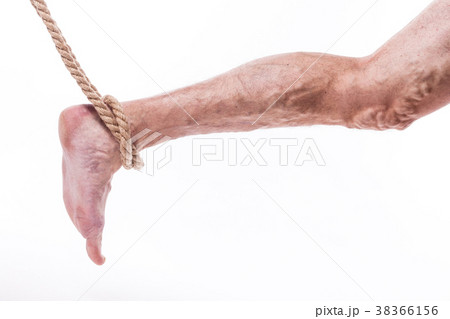rope holding human leg ailing varicose veins of 38366156