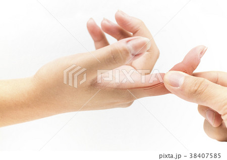 finger nerve pain 38407585