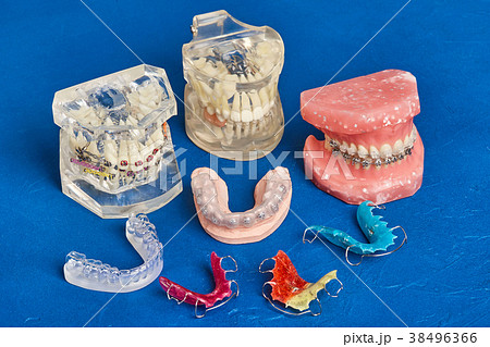 Human jaw or teeth model with dental braces 38496366