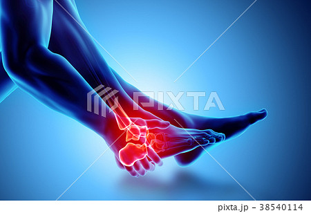 Ankle painful - skeleton x-ray. 38540114