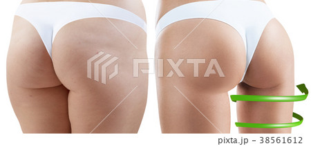 Big spiral arrows shows result of slimming on 38561612