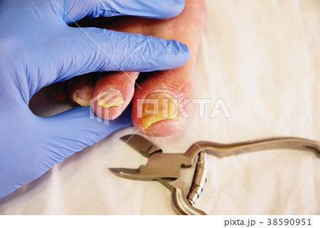 Pedicurist hands in sterile gloves cut nails Pedicurist hands in sterile gloves cut nails 38590951