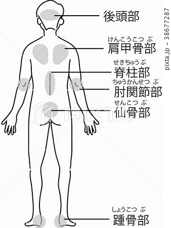 医療 介護 背中 床ずれ 褥瘡のイラスト素材