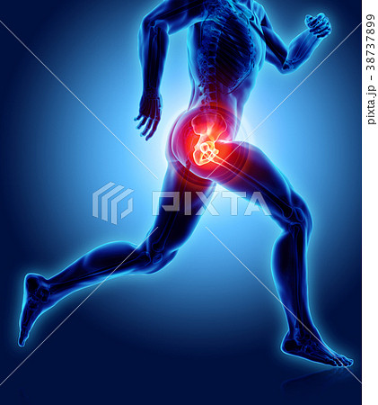 Hip painful skeleton x-ray, 3D illustration. 38737899