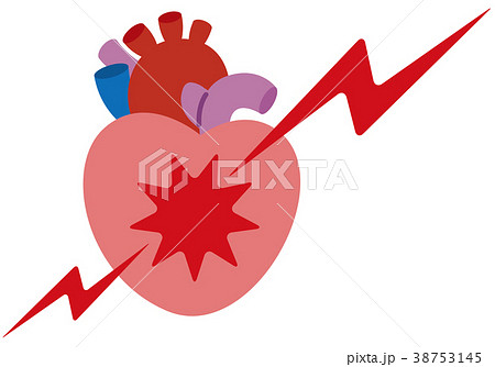 心臓 痛み 病気 症状 心臓 痛み 病気 症状 38753145