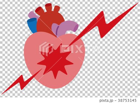 心臓 痛み 病気 症状 心臓 痛み 病気 症状 38753145