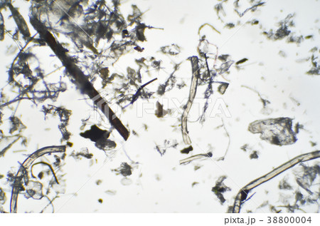 顕微鏡でみたハウスダスト 顕微鏡でみたハウスダスト 38800004