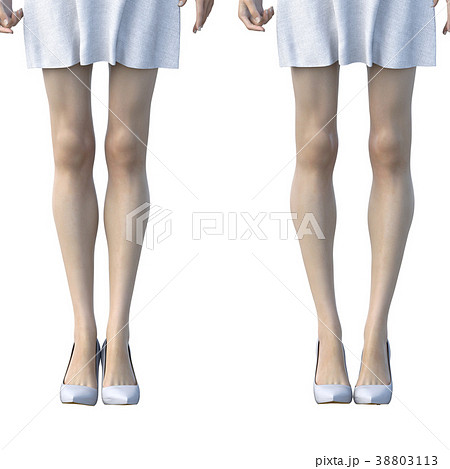 O脚の女性　比較　perming3DCGイラスト素材 38803113