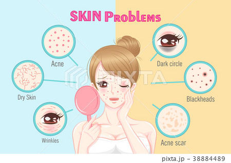 woman with skin problem 38884489
