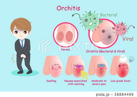 businessman with orchitis 38884499