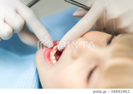 Close-up dentist hand showing milk teeth and molar 38892862