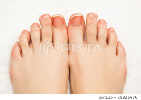 Female toe nails without pedicure. Lack of 38926876