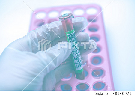 血液検査 38930929