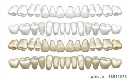 Teeth Whitening Vector. Before And After. Tooth 38955378