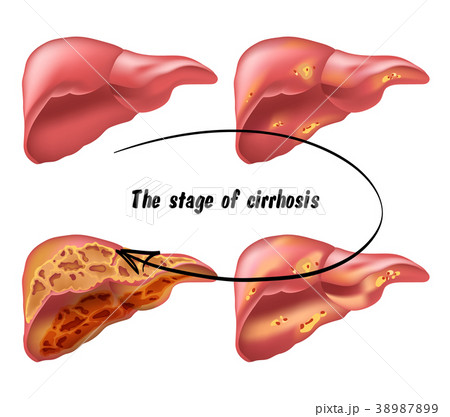 medical structure of the liver 38987899