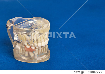 Human teeth orthodontic dental model with implants 39007277