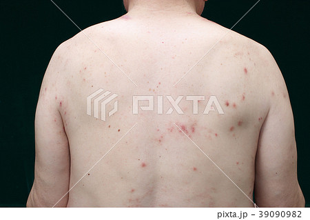 乾燥肌の症状 乾燥肌の症状 39090982