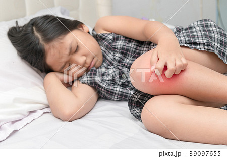Hand scratching ,legs of little girl with swelling Hand scratching ,legs of little girl with swelling 39097655