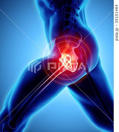 Hip painful skeleton x-ray, 3D illustration. Hip painful skeleton x-ray, 3D illustration. 39101464