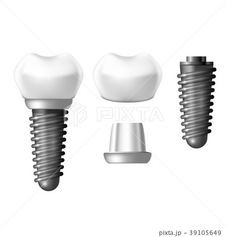 Component parts of dental implant - teeth denture 39105649