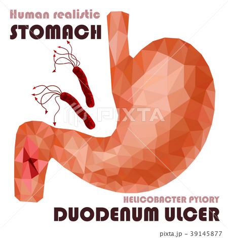 Realistic low poly human stomach and inflammation Realistic low poly human stomach and inflammation 39145877