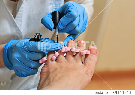 Chiropody 39151513