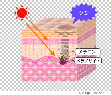 Skin sectional view sunburn stain Skin sectional view sunburn stain 39154502
